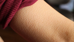 EDM Goosebumps